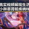 国产真实视频展现生活百态 网络小胖患肾脏疾病样貌大变引发全网吃瓜
